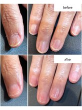 ケアプラス(care plus)/ハンドネイルケア