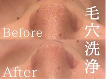 ソイズエステティクス