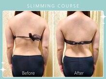 ハノハノ 八代店(HANO HANO)/選べる12種の痩身脂肪撃退☆