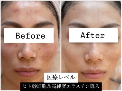 テラ(terra.)の写真