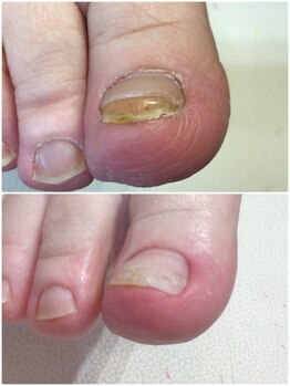 モアクリスタル(More Crystal)/