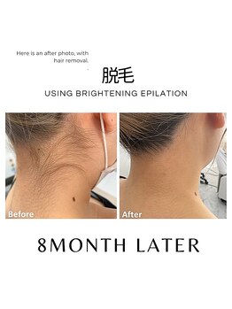 ハグミー 甲子園口(HUGME.)/うなじ美人★