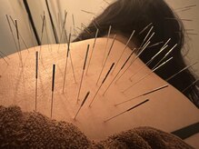 けんたろう鍼灸院/肩こり　