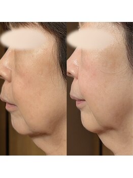 ルマ(Rumah)/極上ヘッドスパとたるみケア