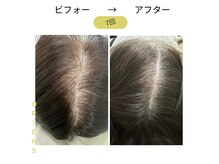 オリエンス(oriens)の雰囲気（頭皮も肌質も改善！サロンでエクソソーム100%トリプルショット☆）