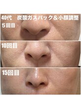 太陽と月/炭酸ガスパック＆全身リンパ