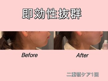 薬手名家 心斎橋店/お客様ビフォーアフター