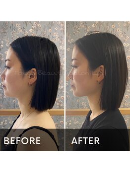 トータルビューティーサロンリア(Li'a)/エラ張り/小顔/バランス