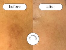 ユヌランコント 岐阜店(Une rencontre)/エンビロン×シミケア