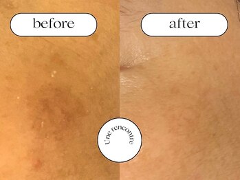 ユヌランコント 岐阜店(Une rencontre)/エンビロン×シミケア