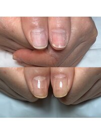 美フォルム自爪育成