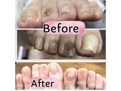 ウォーク(Walk)の写真