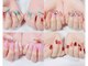 シュシュ(chou.chou)の写真