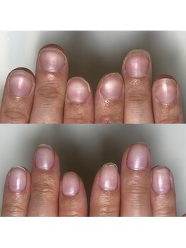 フェミニンネイル(Feminine Nail)/