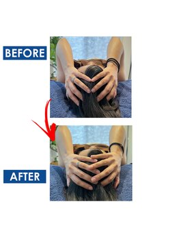 リアン(Liam)/小顔矯正/頭蓋骨調整/美容整体