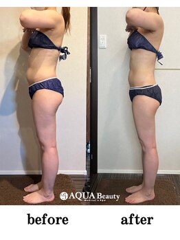 ビーエスアクアビューティー/全身ボディ