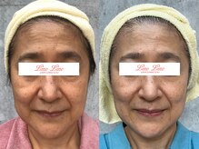 エステティックサロン リノリノ(Lino Lino)/ADS部門★セミファイナル受賞