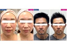 コリオ(KoRiO)の雰囲気（効果がすく出る切らないリフトアップ！即効性を求めてる方）