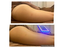 ミキ 西新宿(MIKI)の雰囲気（リラックスしながら、むくみ・硬脂ケアでスッキリBODYへ）