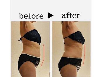 サロン ド ユキフラン(Salon de Yukifranc)/施術部位→お腹・ウエスト