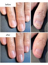 ケアプラス(care plus)/ハンドネイルケア