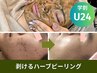 【学割u24】剥離ハーブピーリング！ダウンタイムなし！24歳以下限定