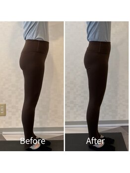 ジュノ(JUNO)/姿勢改善で下半身ライン変化