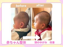らくだ整骨院/赤ちゃん整体