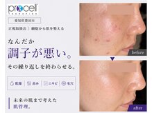 ル シーニュ