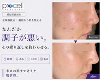 ル シーニュ