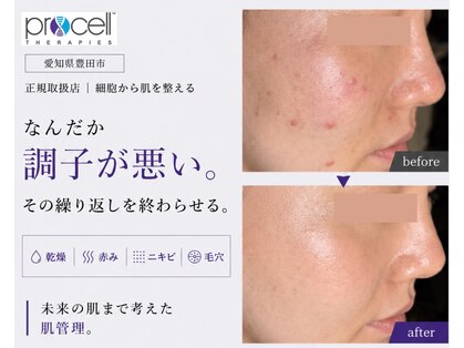 ル シーニュの写真