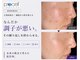 ル シーニュの写真