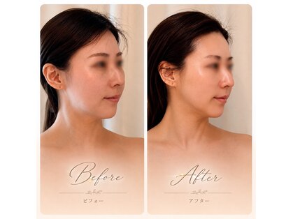 アミュ ル ブラン ナゴヤ(AMU Le blanc NAGOYA)の写真