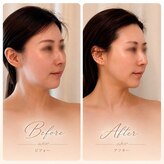 アミュ ル ブラン ナゴヤ(AMU Le blanc NAGOYA)