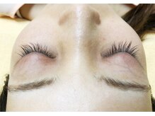 ボディキュア(BODYQA)/セラム使用3ヶ月後