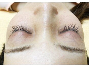 ボディキュア(BODYQA)/セラム使用3ヶ月後