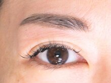 チェリーアイ(cherry eye)