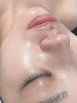 ワイドット(Y.)の写真/艶肌WAX認定サロン◇誰もが憧れる艶肌が手にできる!ニキビケアや毛穴・肌トラブル改善したい方におすすめ♪