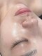 ワイドット(Y.)の写真/艶肌WAX認定サロン◇誰もが憧れる艶肌が手にできる!ニキビケアや毛穴・肌トラブル改善したい方におすすめ♪
