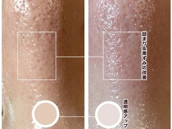 イヨヨ(iyoyo)/毛穴洗浄”水光アクアピール”