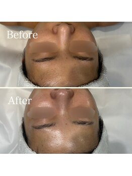 リノユー ビューティー(Lino U Beauty)/【アンストレスで水分力UP！】