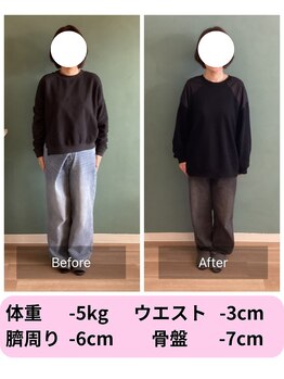 パンダ(Panda)/美骨鍼灸ダイエット