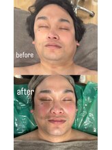 クレール(claiRE)/フェイシャル♪