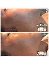 メンズ シンバ(SIMBA)/