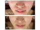 アンドボーテ(&BEAUTE)の写真