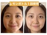 モニター募集【もたつき・たるみ改善】レモンボトルあご下のみ
