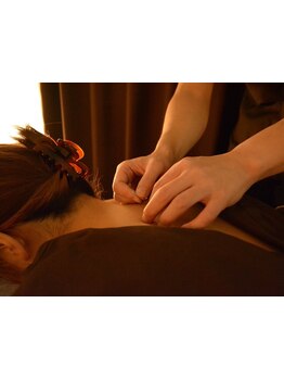 鍼灸施術を受けたい