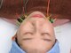 セキ鍼灸院の写真/【国家資格保持】今人気の美容鍼を当院で!血行促進/お肌のハリUP/シミ・しわ改善/むくみ改善などにお勧め♪