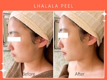 シロカネ イオンタウン西熊本店(SHIROKANE)/韓国肌管理ララピール☆