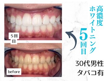 ルカノン(le canon)/さわやか営業マンになりました！